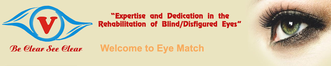 welcome to artificialeye.co.in, Artificial Eye in india,artificial eye in punjab, Eye prosthesis in india, artifical eyes, artificial eye jalandhar,artificial eye in punjab,Eye prosthesis in jalandhar,Eye prosthesis in punjab